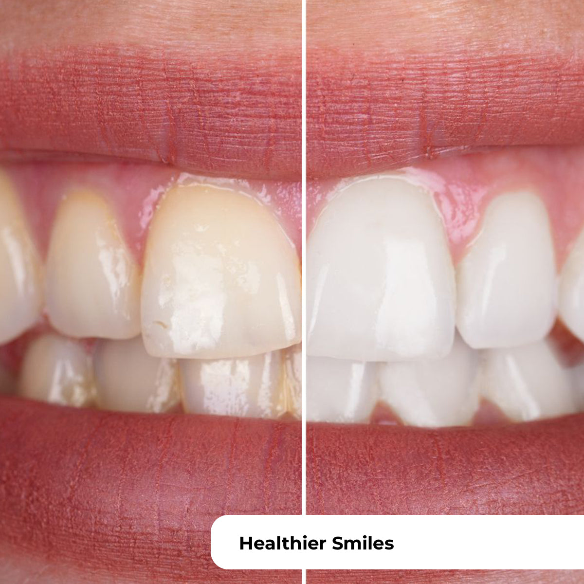 PUURSMILE WATER FLOSSER - 50% OFF HALLOWEEN SALE