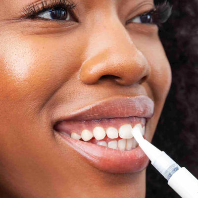 Teeth Whitening Kit (Preview Only)